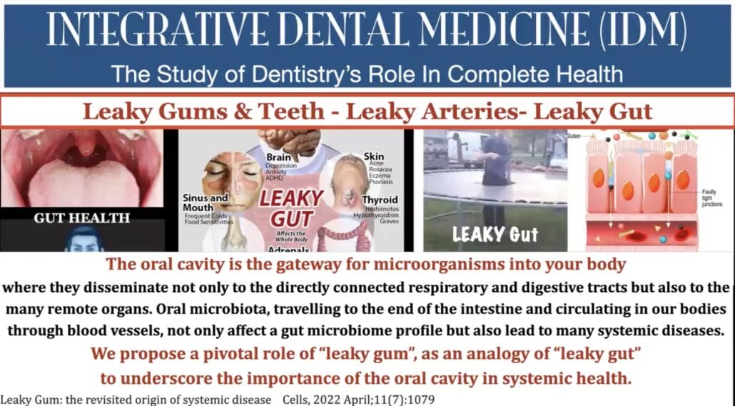 Text of dental sleep & airway education slide that is emphasizing oral systemic health including leaky gut